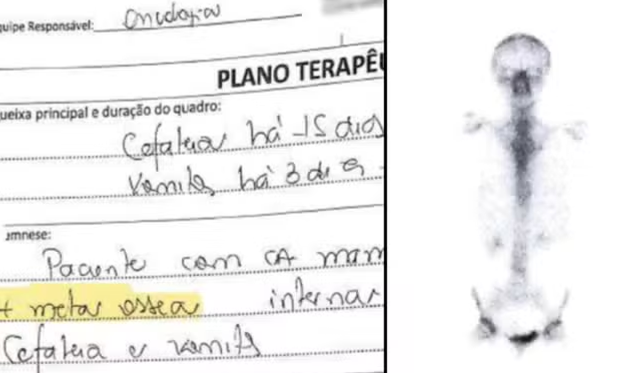 Por erro médico, mulher trata câncer inexistente durante 6 anos em SP: 'tormento, dor crônica, perda óssea, fadiga'