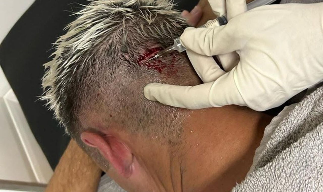 Homem com ferimento na cabeça dá entrada no Hospital Municipal em Quirinópolis