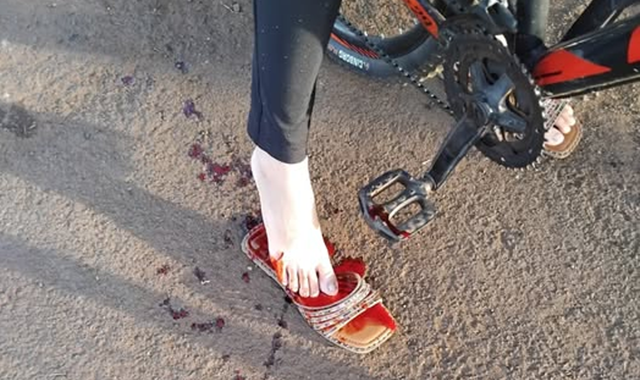 CICLISTA É ATACADA POR CACHORRO EM QUIRINÓPOLIS