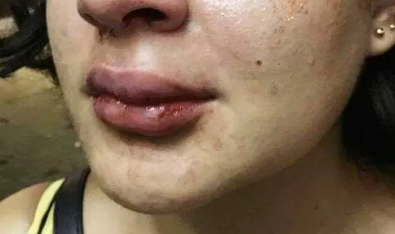 MULHER É AGREDIDA COM SOCO NO ROSTO DURANTE CONFUSÃO FAMILIAR EM QUIRINÓPOLIS