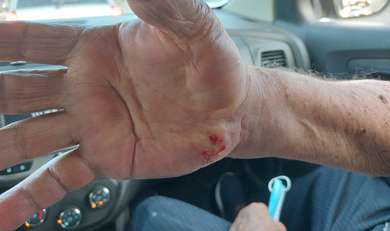 HOMEM É PICADO POR COBRA NO BAIRRO MORADA NOVA, EM QUIRINÓPOLIS