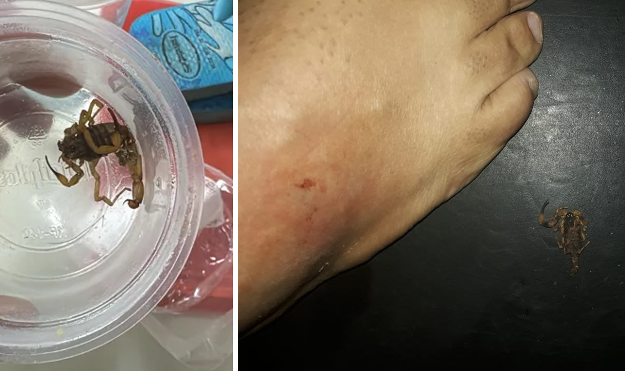 ESTUDANTE É PICADO POR ESCORPIÃO DENTRO DE TÊNIS EM ESCOLA DE QUIRINÓPOLIS
